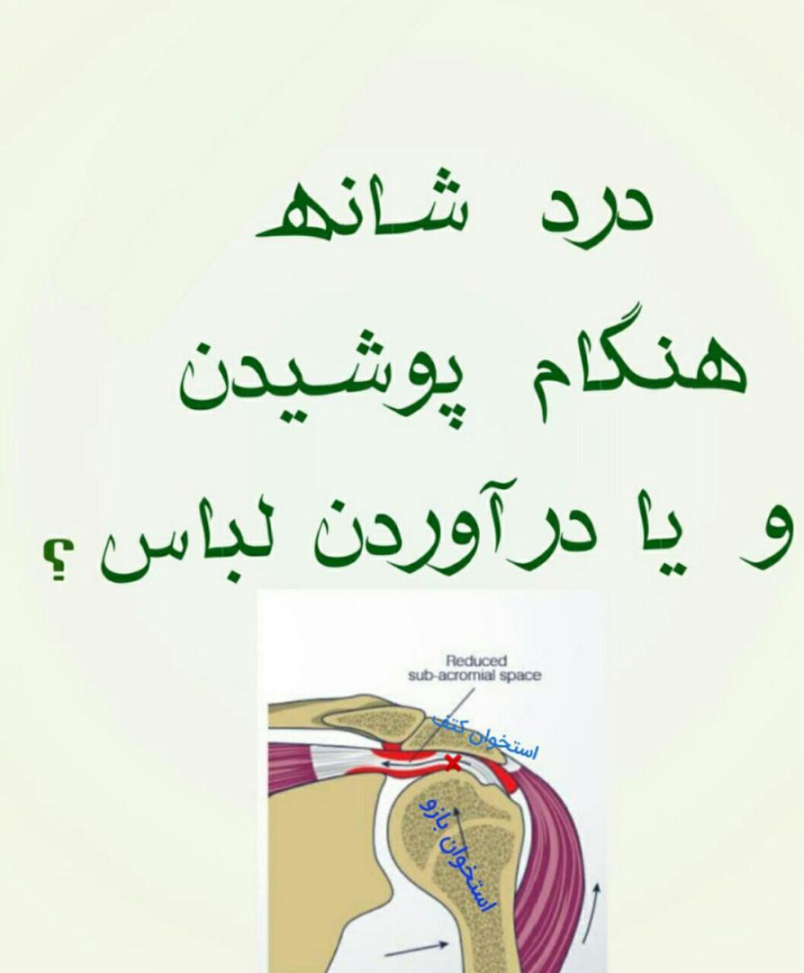 ایجاد درد حین تعویض لباس 2